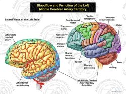 Bloodflow and Function of the Left Middle Cerebral Artery Territory