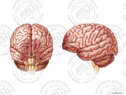 Anterior and Left Lateral Brain Contusions – No Text