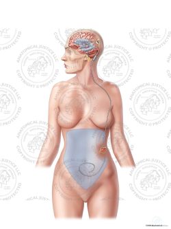 Female Left Posterior Ventriculo – Peritoneal Shunt – No Text