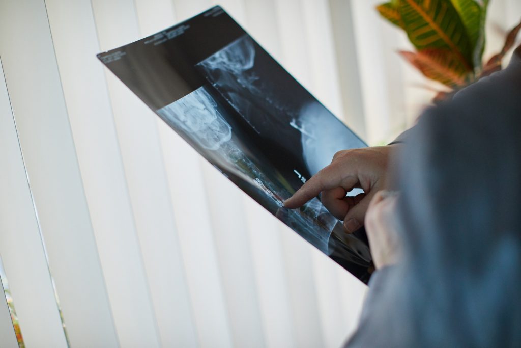 Medical Illustrators look at the pathology on radiological films