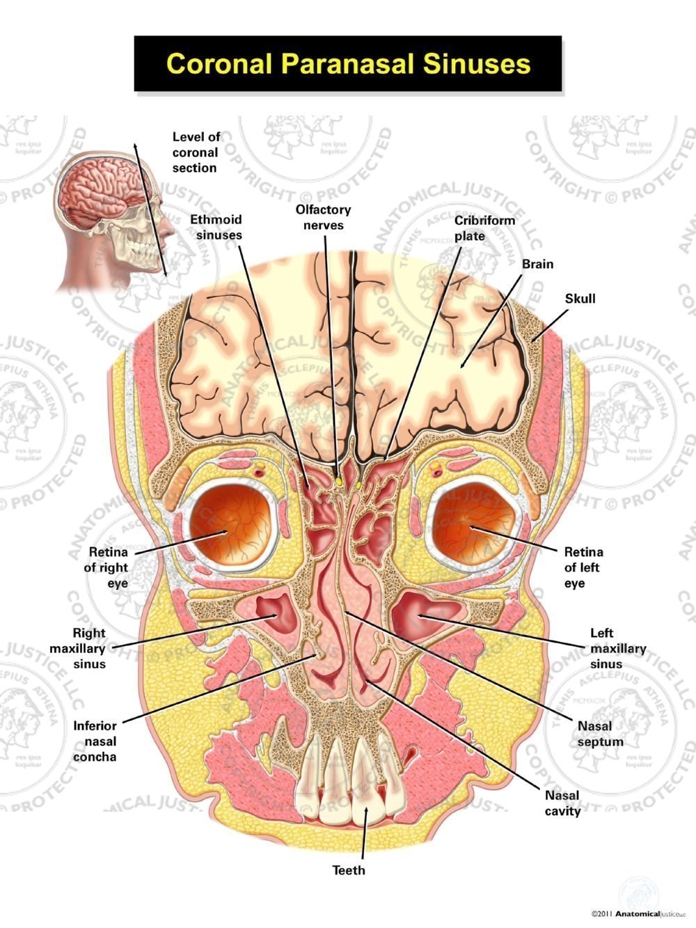 Coronal Paranasal Sinuses