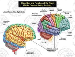 Bloodflow and Function of the Right Middle Cerebral Artery Territory