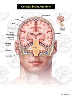 Coronal Brain Anatomy – Adult