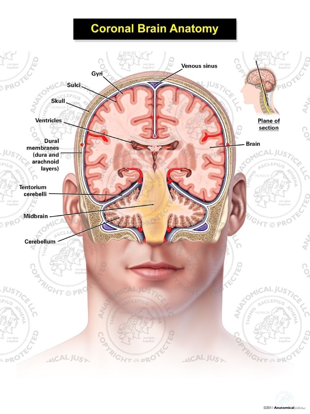 Coronal Brain Anatomy – Adult