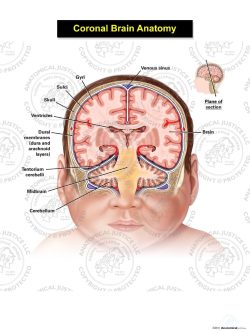 Coronal Brain Anatomy – Infant