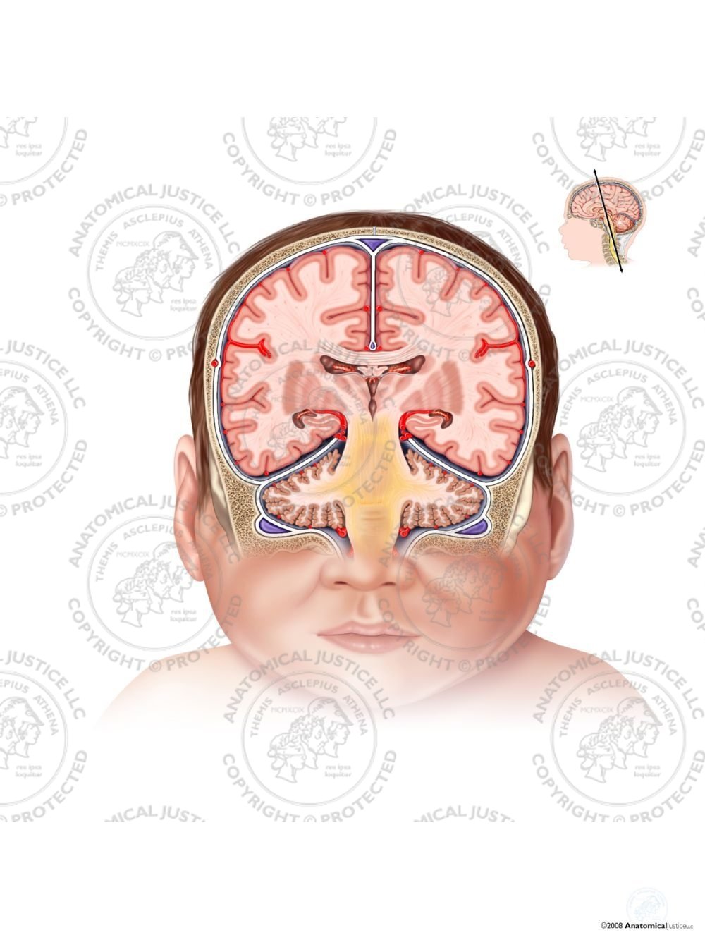 Coronal Brain Anatomy – Infant – No Text