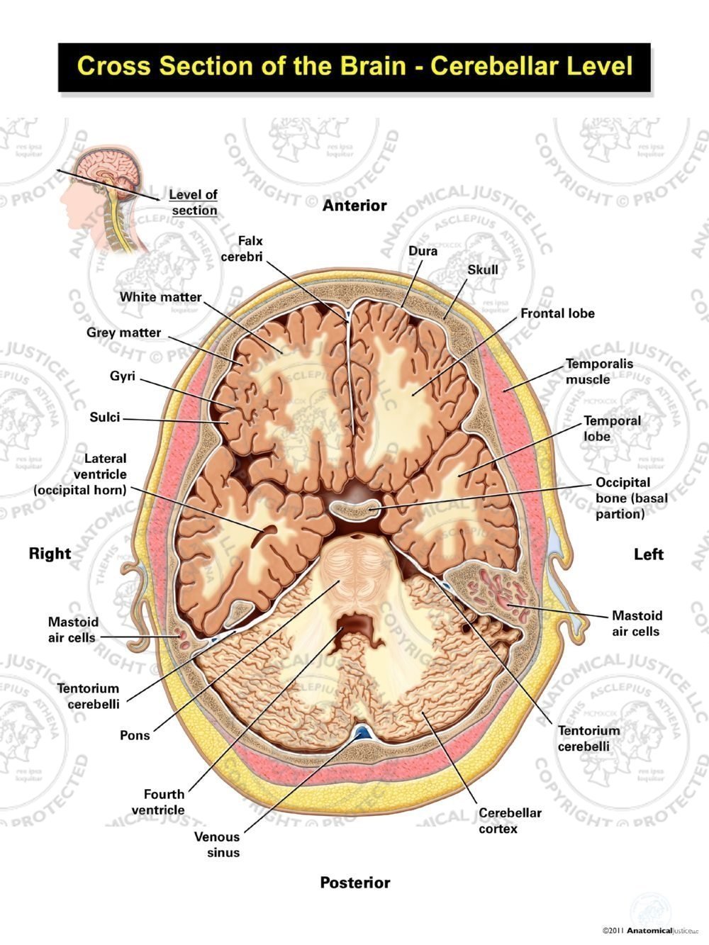 Cross Section of the Brain – Cerebellar Level