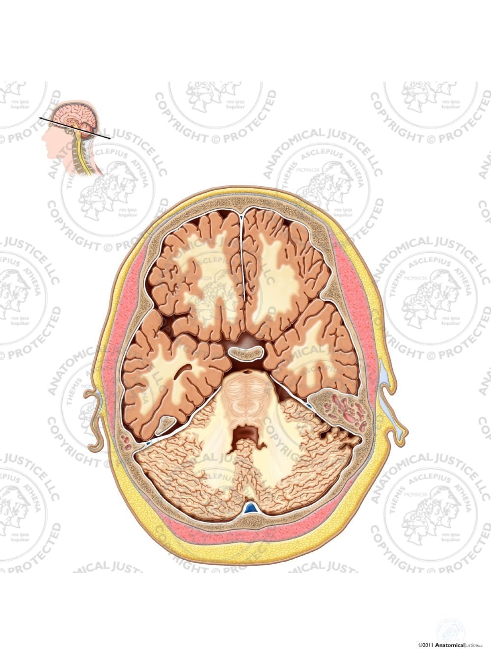 Cross Section of the Brain – Cerebellar Level – No Text
