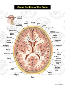 Cross Section of the Brain – Ventricular Level