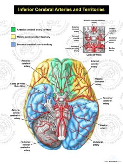 Inferior Cerebral Arteries and Territories