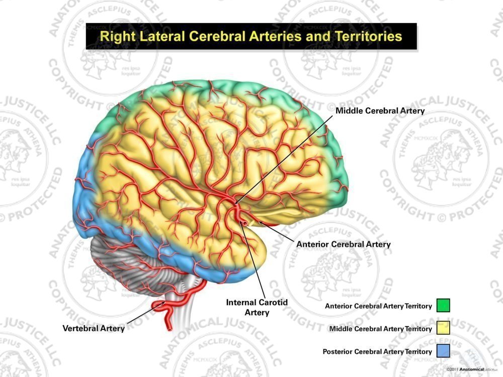 Right Lateral Cerebral Arteries and Territories
