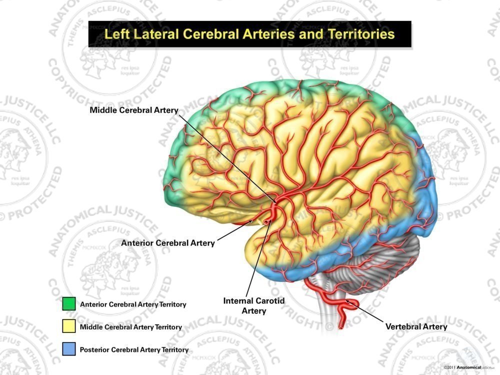 Left Lateral Cerebral Arteries and Territories