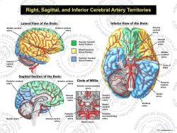 Right, Sagittal, and Inferior Cerebral Artery Territories