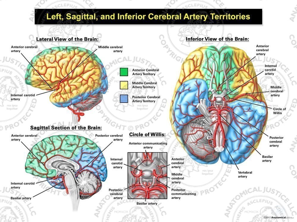 Left, Sagittal, and Inferior Cerebral Artery Territories