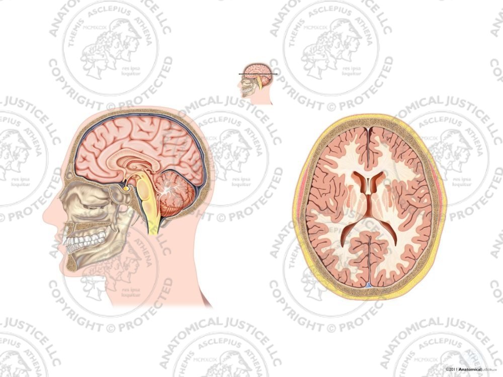 Sagittal and Axial Sections of the Brain – No Text