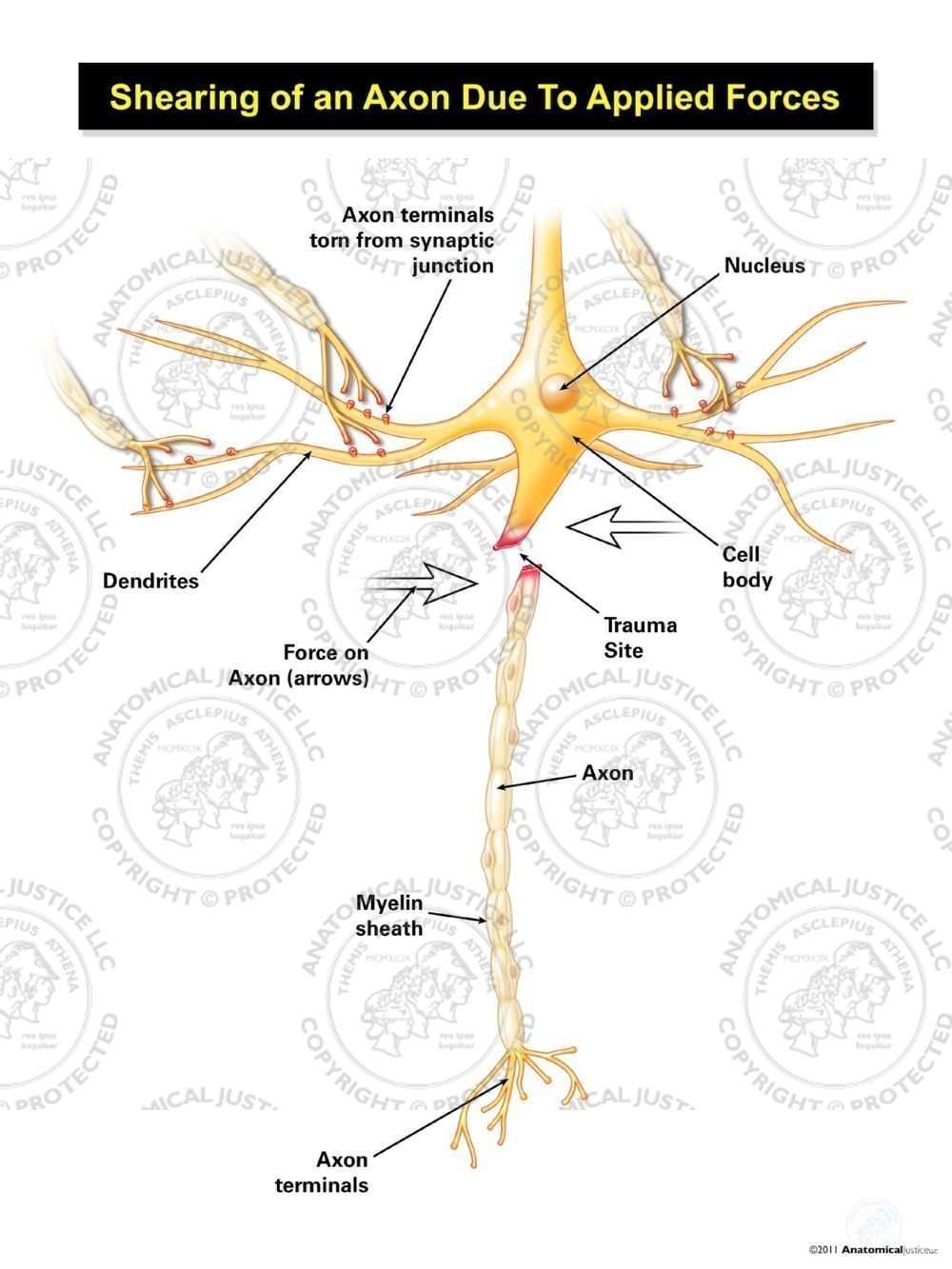 Shearing of an Axon Due To Applied Forces – White