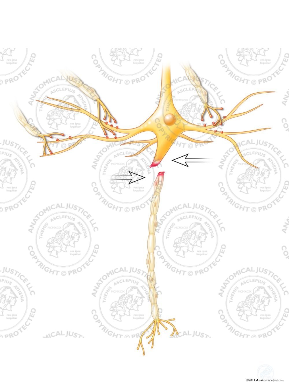 Shearing of an Axon Due To Applied Forces – White – No Text
