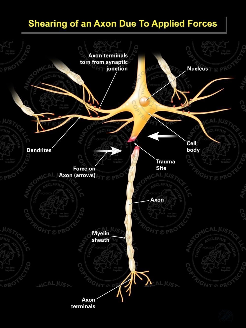 Shearing of an Axon Due To Applied Forces – Black