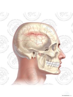 Right Middle Meningeal Artery Injury – No Text