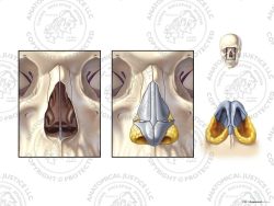 Anatomy of the Nose – No Text