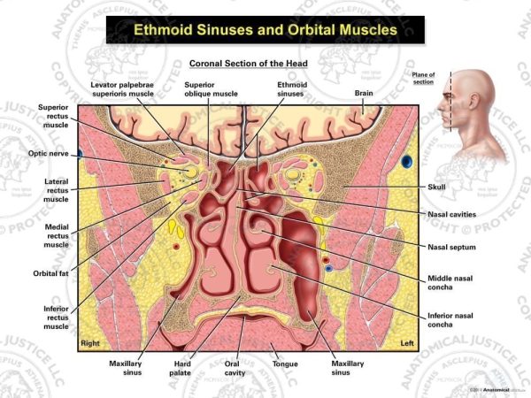 Ethmoid Sinuses And Orbital Muscles 