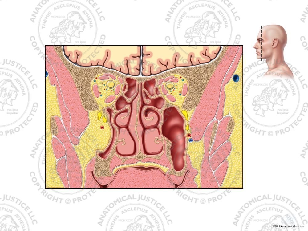 Ethmoid Sinuses and Orbital Muscles – No Text