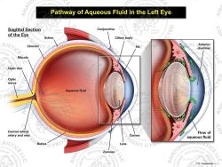 Pathway of Aqueous Fluid in the Left Eye