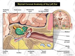 Normal Coronal Anatomy of the Left Ear