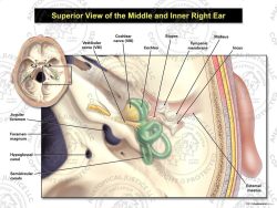 Superior View of the Right Middle and Inner Ear