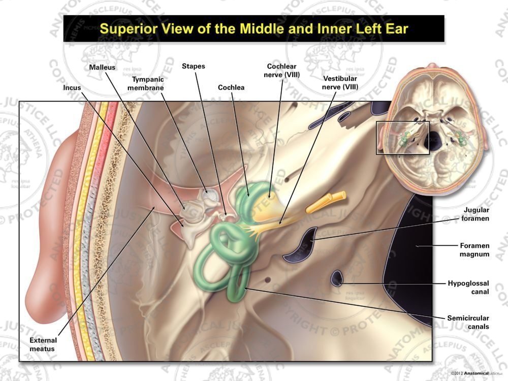 Superior View of the Left Middle and Inner Ear