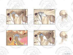 Anatomy of the Right Temporomandibular Joint (TMJ) – No Text