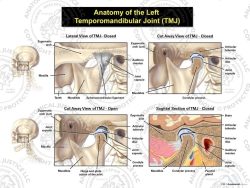 Anatomy of the Left Temporomandibular Joint (TMJ)