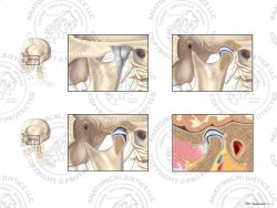 Anatomy of the Left Temporomandibular Joint (TMJ) – No Text