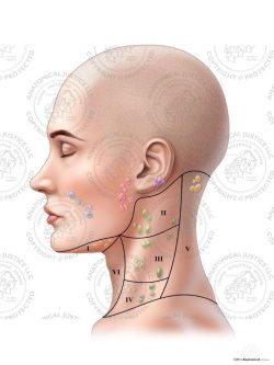 Female Left Lymph Nodes and Regions of the Neck – No Text