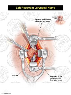 Male Left Recurrent Laryngeal Nerve