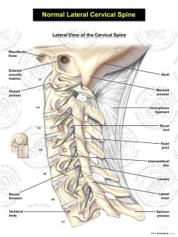 Normal Lateral Cervical Spine