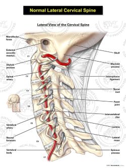 Normal Lateral Cervical Spine and Arteries