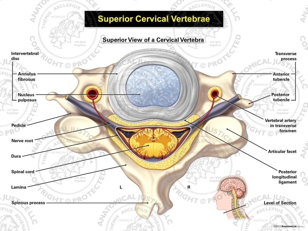 Normal Cervical Vertebra