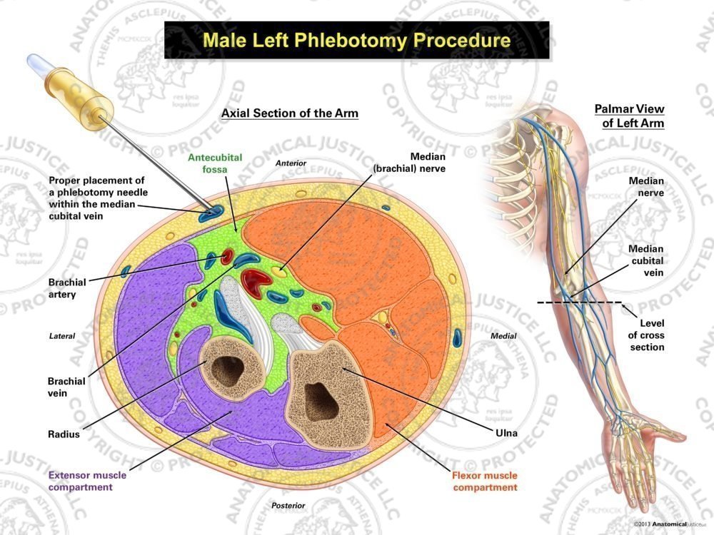 Male Left Phlebotomy Procedure