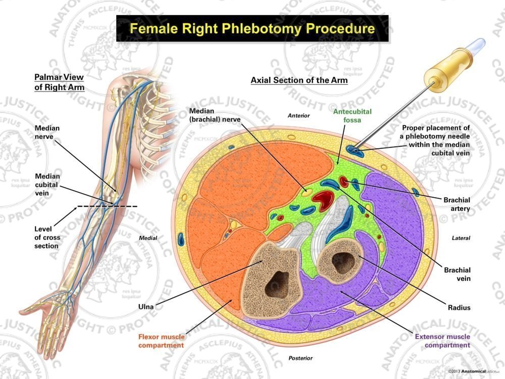 Female Right Phlebotomy Procedure