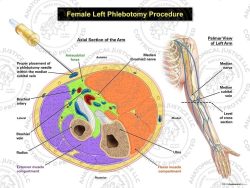 Female Left Phlebotomy Procedure