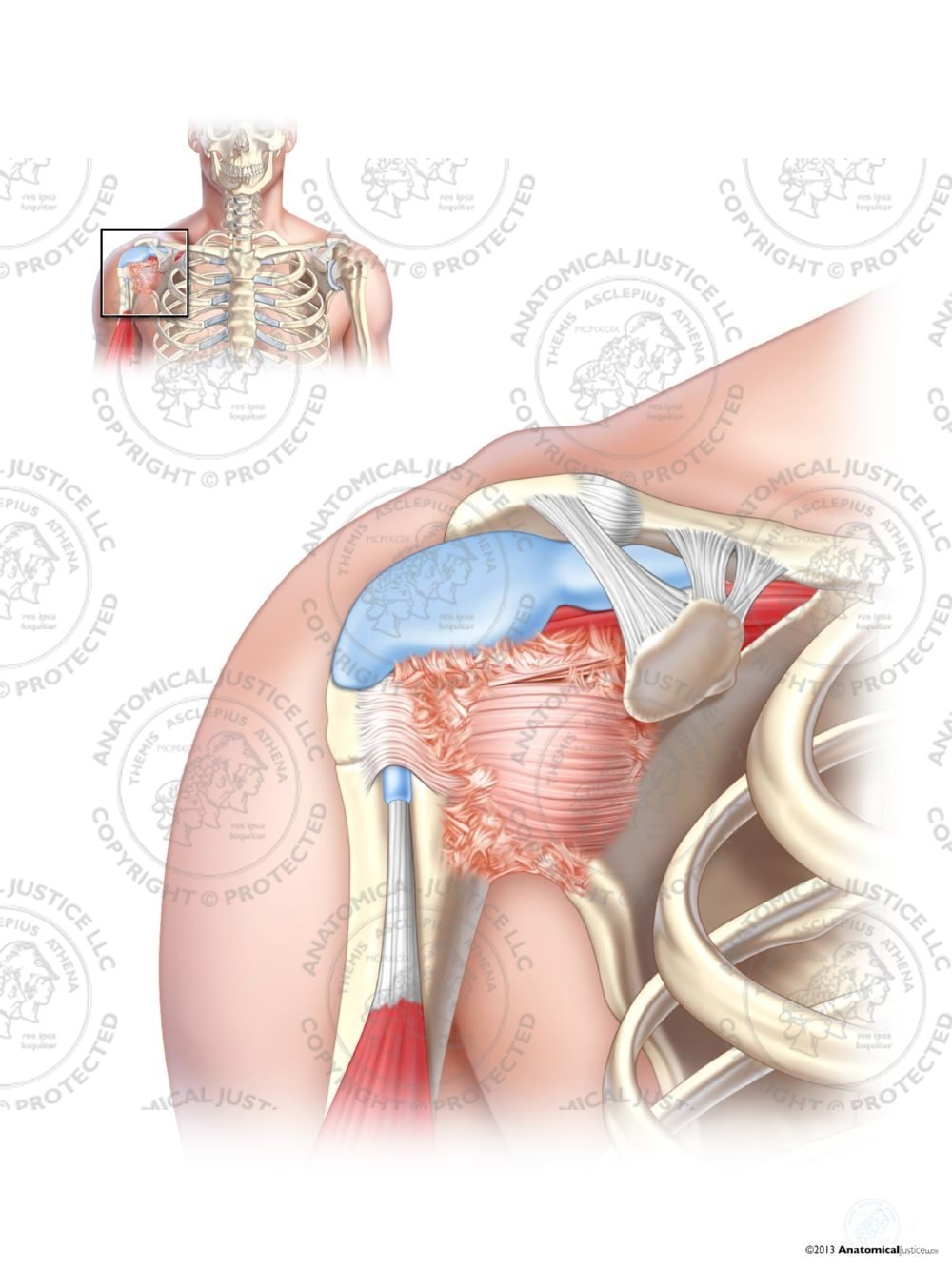 Adhesive Capsulitis of the Right Shoulder – No Text