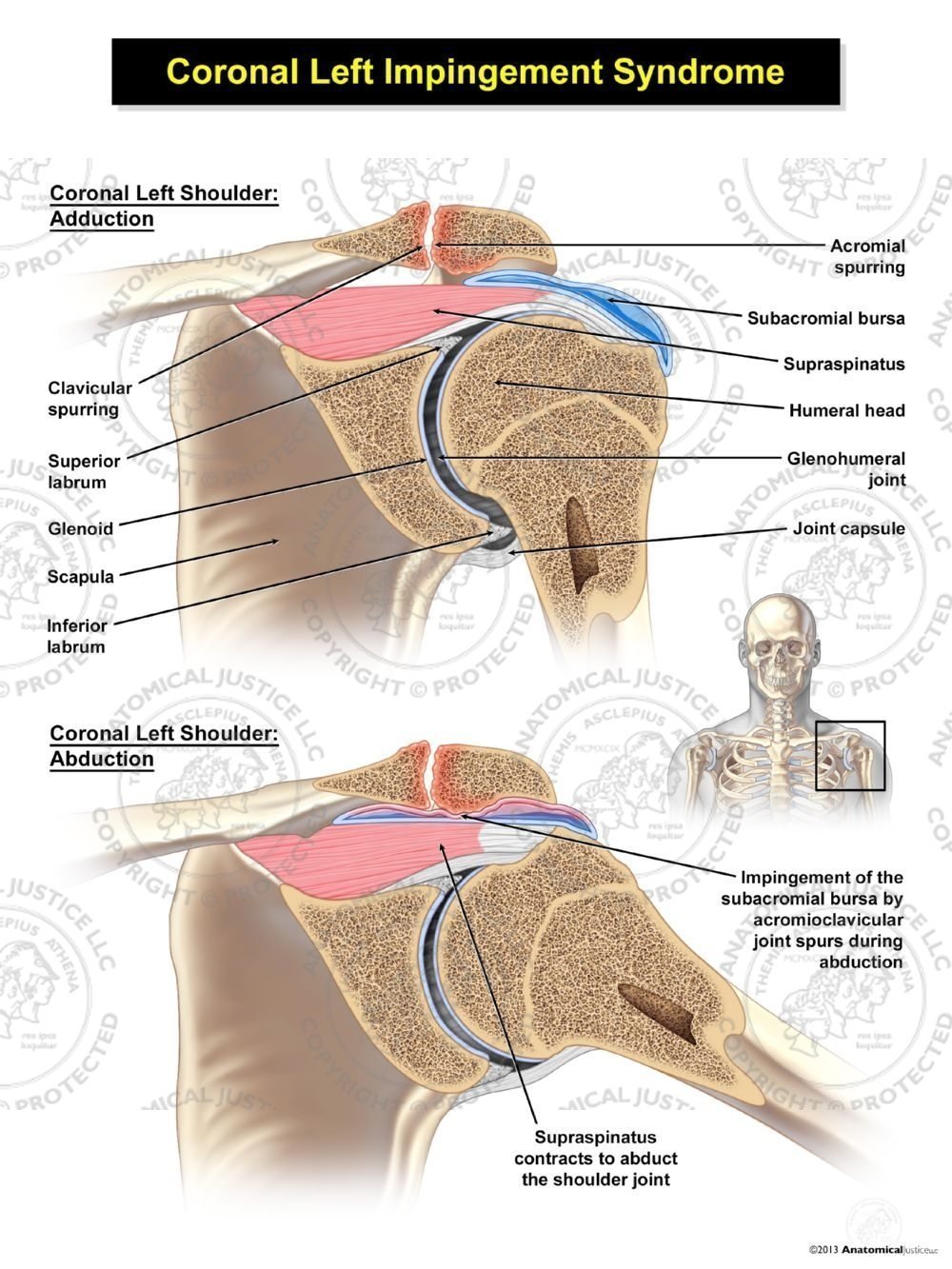 Cubital Tunnel Syndrome Brace  Ulnar Nerve Elbow Treatment Splint