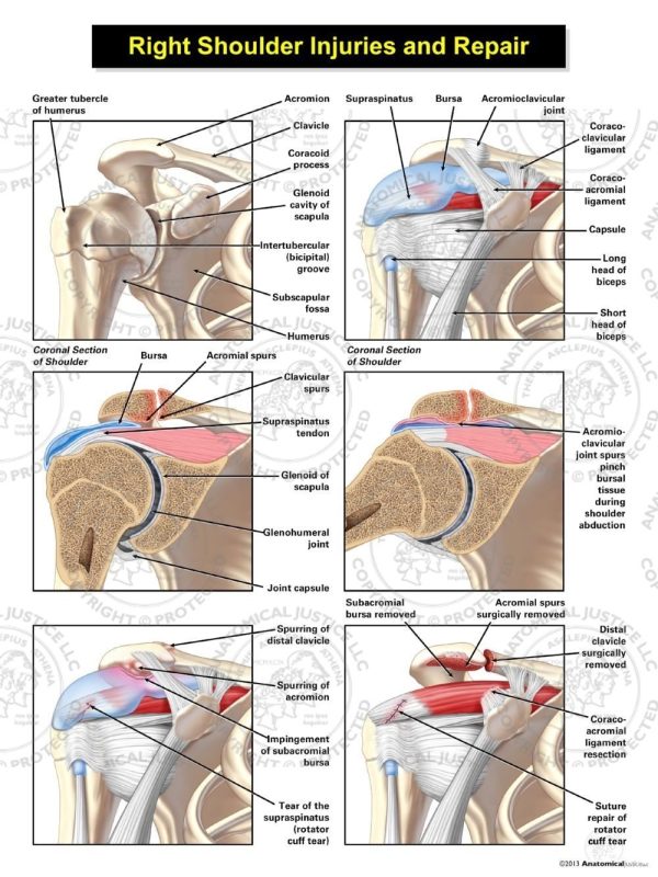 Right Shoulder Injuries and Repair