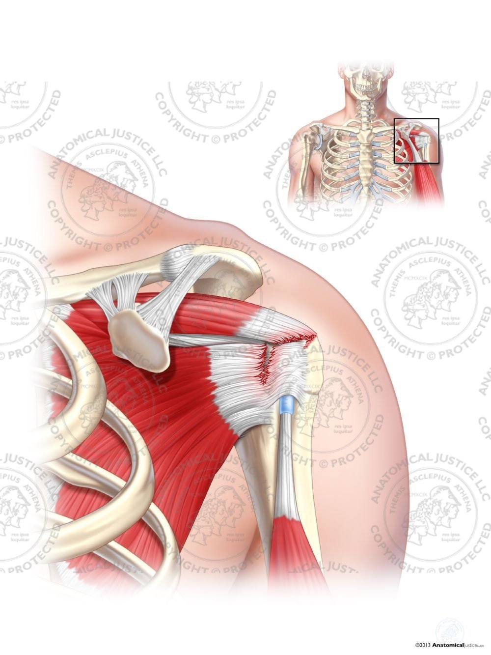 Supraspinatus Anatomy Anatomical Charts And Posters 4777