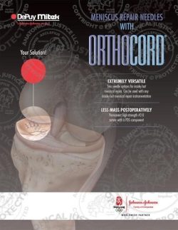 Meniscus Repair Needles with Orthocord Brochure
