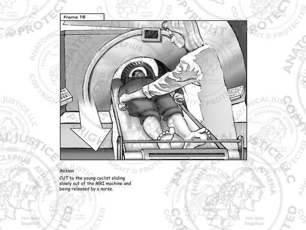 MRI Storyboards