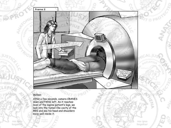 MRI Storyboards