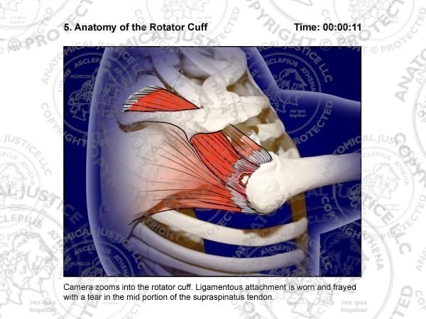 Arthroscopic Rotator Cuff Repair Surgical Storyboards