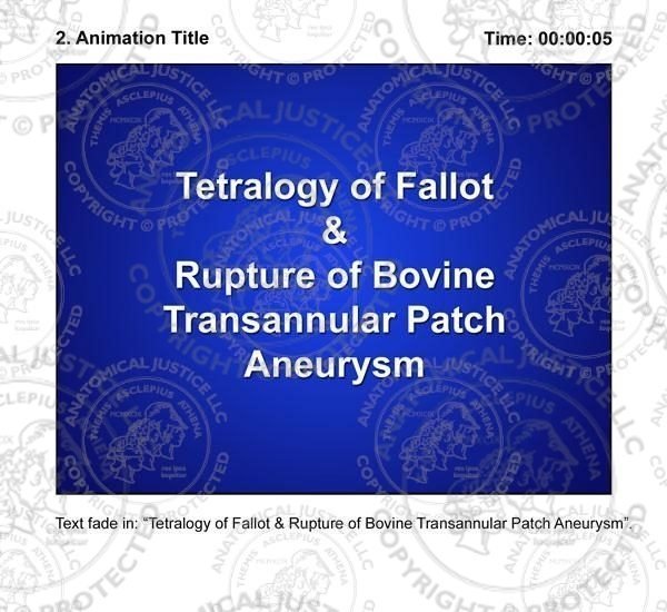 Tetralogy of Fallot & Transannular Patch Aneurysm Storyboards